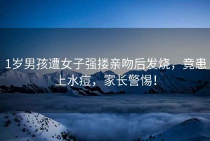 1歲男孩遭女子強摟親吻后發(fā)燒，竟患上水痘，家長(cháng)警惕！