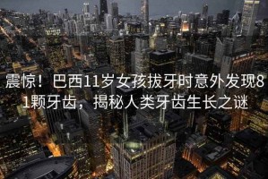 震驚！巴西11歲女孩拔牙時(shí)意外發(fā)現81顆牙齒，揭秘人類(lèi)牙齒生長(cháng)之謎
